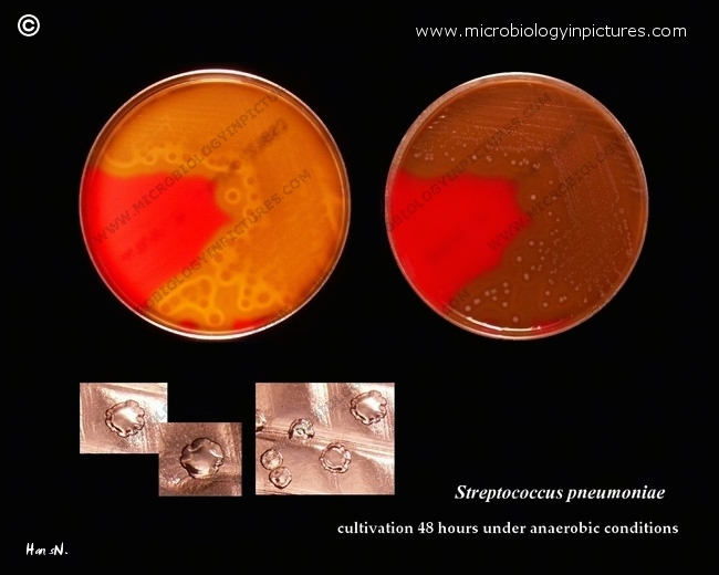 cultivation of pneumococci under anaerobic conditions
